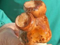 В Донецкой области выросли аномальные трехголовые грибы 