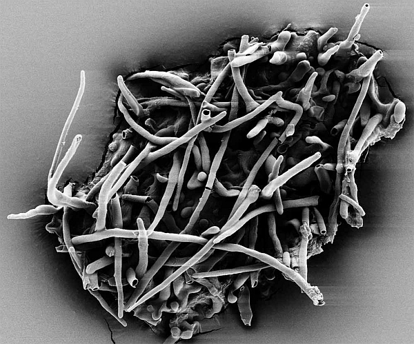 Растрово-электронная микрофотография эктомикоризы